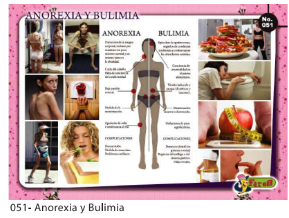 LAMINAS EDUCATIVAS ANOREXIA Y BULIMIA