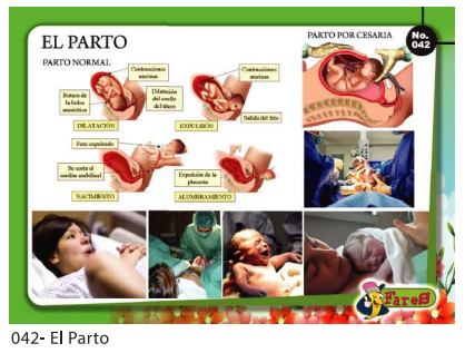 LAMINAS EDUCATIVAS EL PARTO