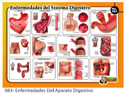 [F83] LAMINAS EDUCATIVAS ENFERMEDADES DEL APARATO DIGESTIVO
